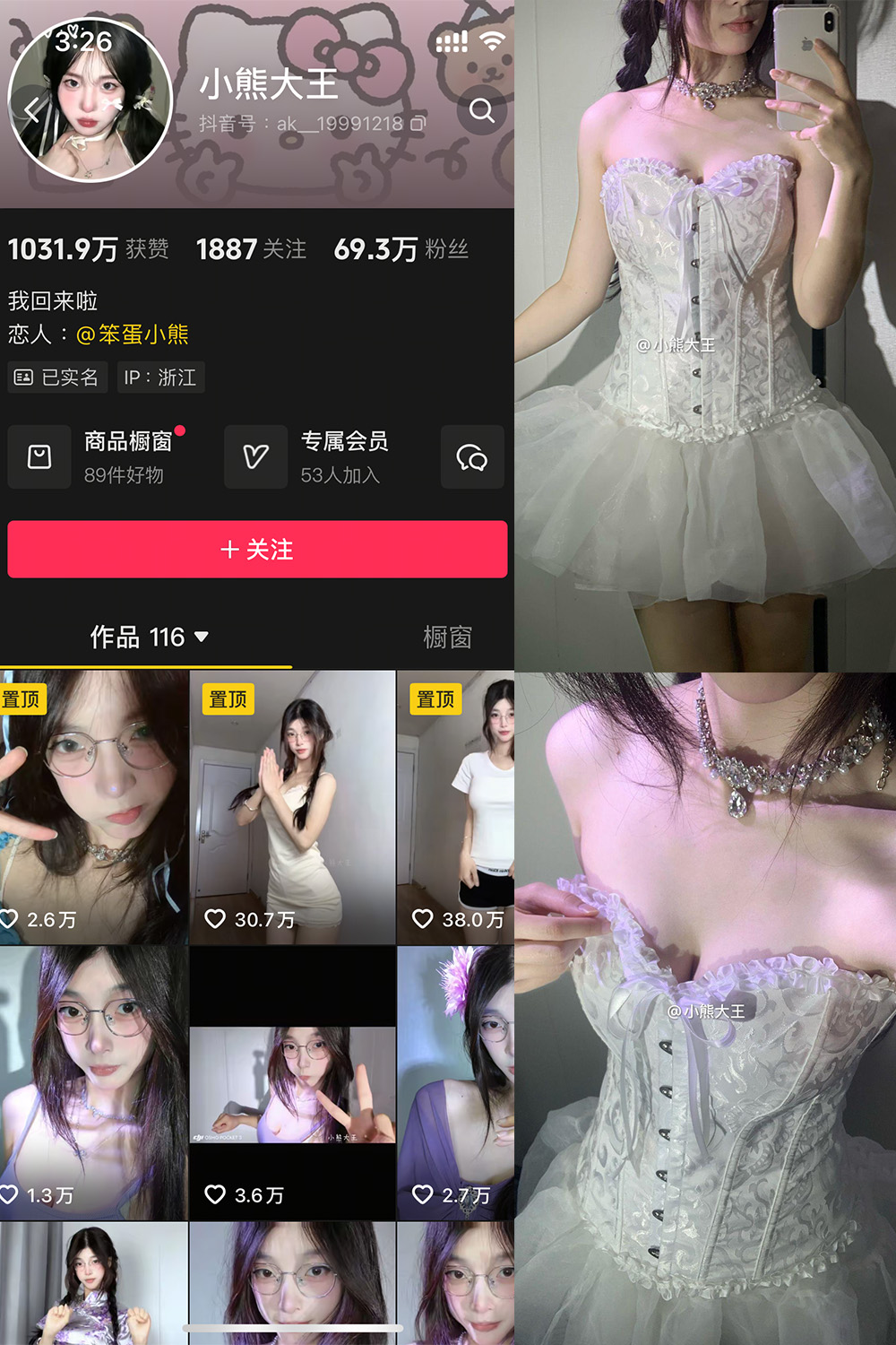 抖音 小熊大王 微密圈 001期 【32P】-睡莲.top